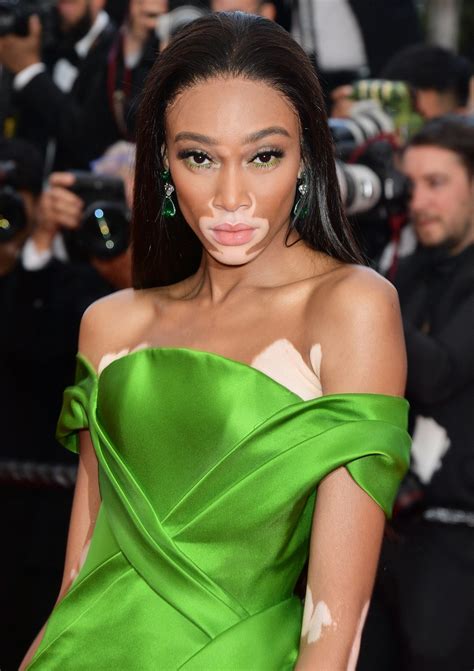 winnie harlow net worth|Winnie Harlow